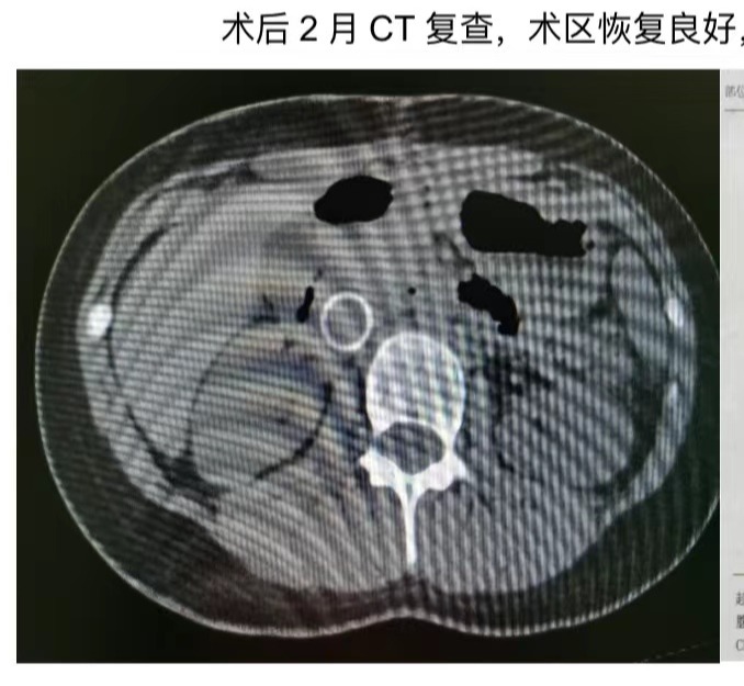 蓝月亮精选资科大全